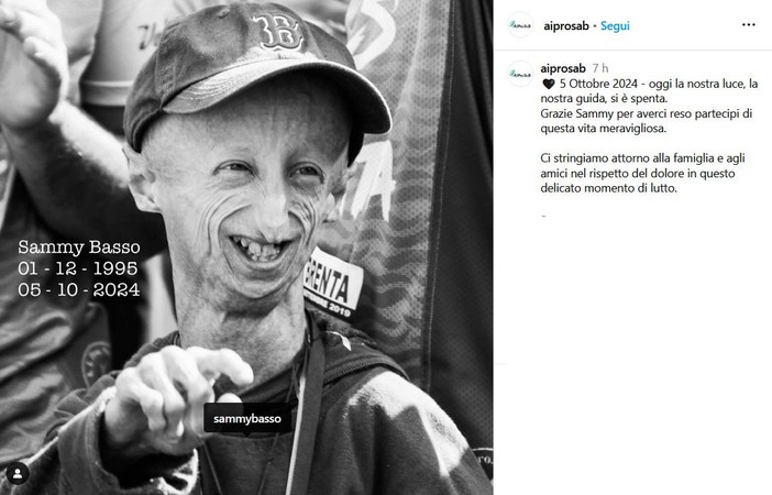 Morto Sammy Basso, il 28enne italiano malato di Progeria